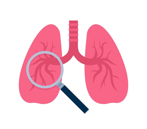 Research Assistant on Lung Cancer Project